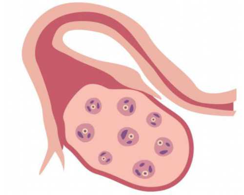 正规代生~准父母试管婴儿好孕美国，坐飞机回中国