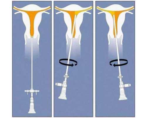 国内正规代怀费用,江苏精子库主任,江苏人类精子库
