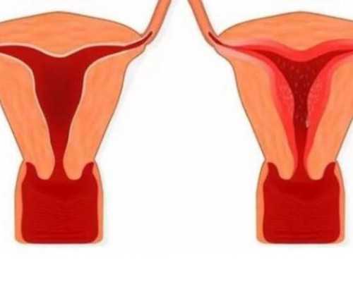 代怀宝宝机构~去泰国去试管婴儿多少钱一次？