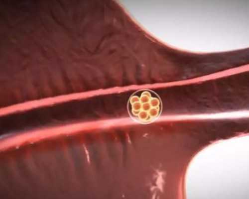 国内借卵代生男孩,儿子熊抱父亲帮其复健，你养我小我护你老！