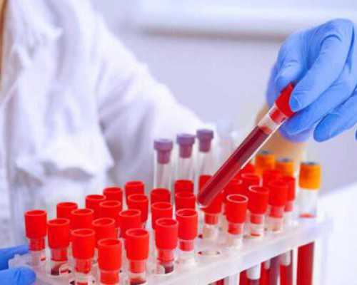 中国代孕最好的机构,做试管婴儿胚胎移植的时候女性身上可以戴金饰吗？