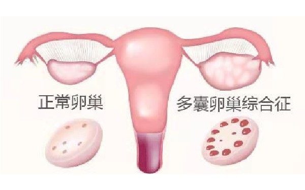 试管婴儿胚胎移植不着床一般多久会正常来月经